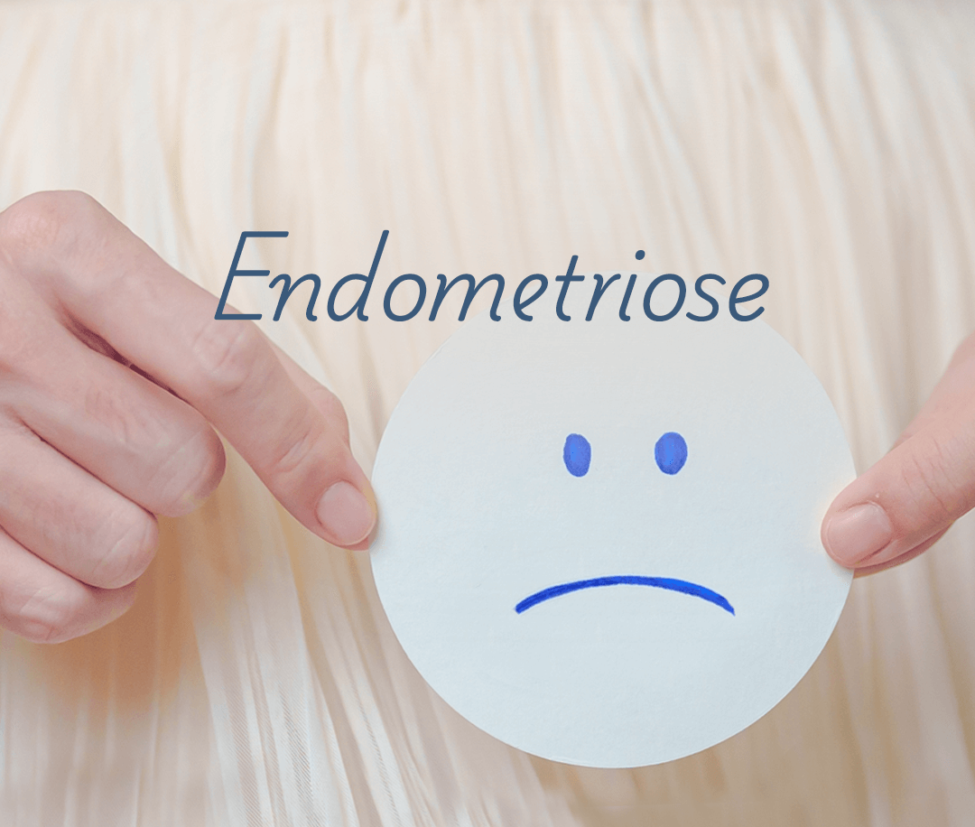 Site-Murilo-Destaques-Home-mobile_endometriose